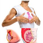 Breast Cancer Kindle Book English Health Fitness Dieting-0